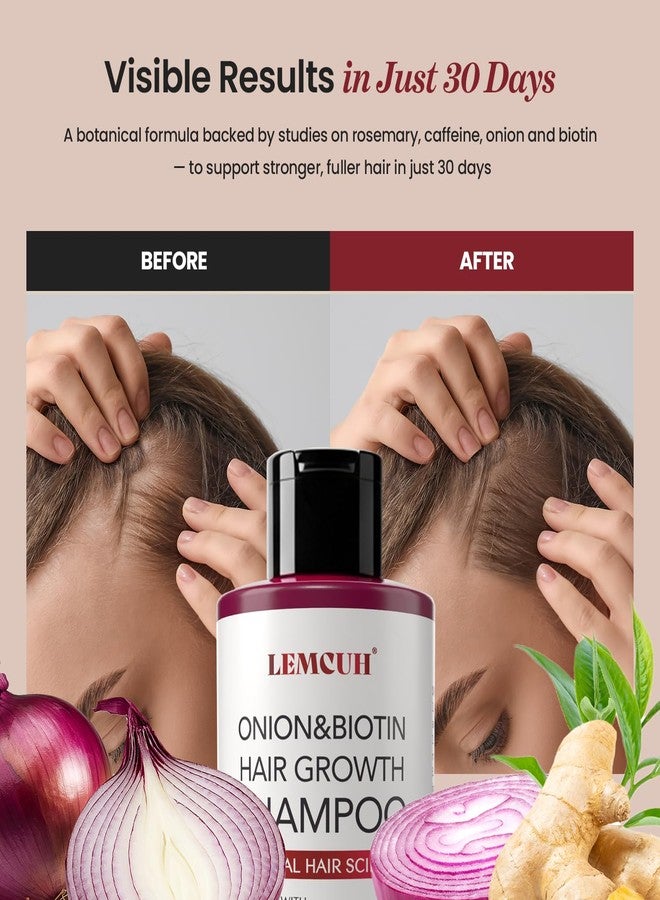 Lemcuh Biotin & Onion Shampoo for Hair Growth: Anti Hair Loss Volumizing Thickening Shampoo for Thinning Hair - Silicone Sulfate-Free Formula with Botanical Nutrients for Sensitive Scalp 2 Pack (25 floz) - Image 4